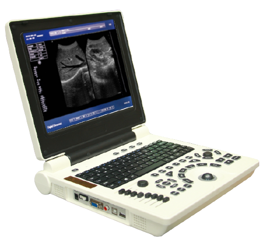 Notebook Ultrasound Machine Oriel Brand