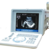 Portable Digital Ultrasound Machine – Oriel Plus